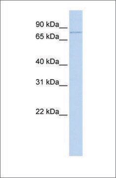 Anti-ZBTB39 antibody produced in rabbit affinity isolated antibody