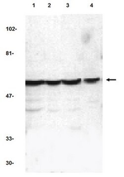 Anti-Caspase-10 Antibody from rabbit, purified by affinity chromatography