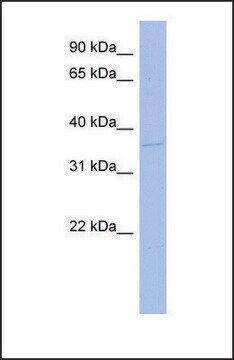 Anti-TLX3, (N-terminal) antibody produced in rabbit affinity isolated antibody