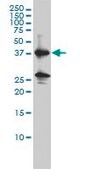 Monoclonal Anti-REN antibody produced in mouse clone 2H2, purified immunoglobulin, buffered aqueous solution