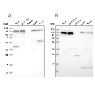 Anti-ERC1 antibody produced in rabbit Prestige Antibodies&#174; Powered by Atlas Antibodies, affinity isolated antibody, buffered aqueous glycerol solution, Ab2