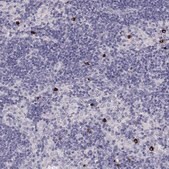 Anti-P2RY10 antibody produced in rabbit Prestige Antibodies&#174; Powered by Atlas Antibodies, affinity isolated antibody