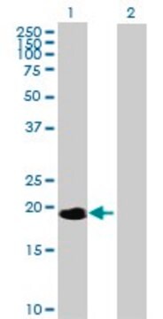 Anti-NME6 antibody produced in mouse purified immunoglobulin, buffered aqueous solution