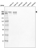 Monoclonal Anti-LAMA1 antibody produced in mouse Prestige Antibodies&#174; Powered by Atlas Antibodies, clone CL2968, purified immunoglobulin, buffered aqueous glycerol solution