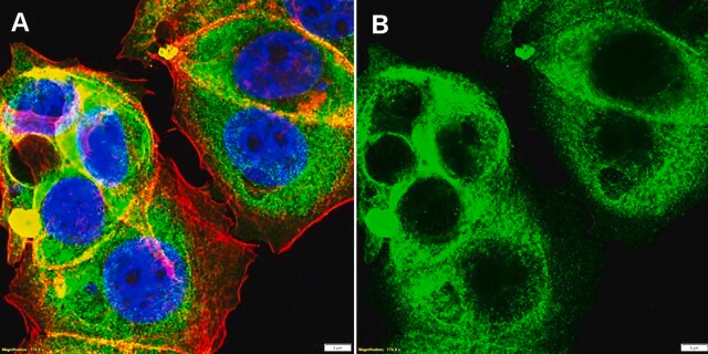 Anti-ARPC5 Antibody, clone 1H16 ZooMAb&#174; Rabbit Monoclonal recombinant, expressed in HEK 293 cells