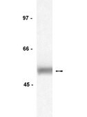 Anti-Lck Antibody, clone 3A5 clone 3A5, Upstate&#174;, from mouse