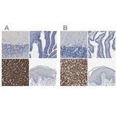 Anti-CYP2C8 antibody produced in rabbit Prestige Antibodies&#174; Powered by Atlas Antibodies, affinity isolated antibody, buffered aqueous glycerol solution