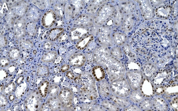 Anti-SMN Antibody, clone 2B1 ZooMAb&#174; Mouse Monoclonal recombinant, expressed in HEK 293 cells
