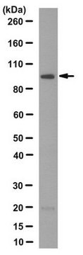 Anti-RNF43 Antibody, clone 11C3.1 clone 11C3.1, from mouse