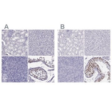 Anti-STAG3 antibody produced in rabbit Prestige Antibodies&#174; Powered by Atlas Antibodies, affinity isolated antibody, buffered aqueous glycerol solution