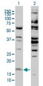 Monoclonal Anti-H3F3B antibody produced in mouse clone 2D7-H1, purified immunoglobulin, buffered aqueous solution