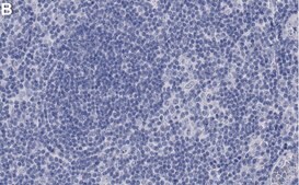 Anti-STAT5B Antibody, clone 2G13 ZooMAb&#174; Rabbit Monoclonal recombinant, expressed in HEK 293 cells