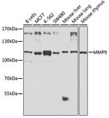 Anti-MMP9 antibody produced in rabbit