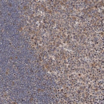 Anti-C7ORF26 antibody produced in rabbit Prestige Antibodies&#174; Powered by Atlas Antibodies, affinity isolated antibody, buffered aqueous glycerol solution