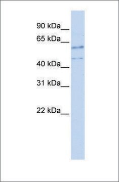 Anti-TP53 (ab3) antibody produced in rabbit affinity isolated antibody