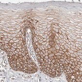 Anti-CTNNB1 antibody produced in rabbit Prestige Antibodies&#174; Powered by Atlas Antibodies, affinity isolated antibody, buffered aqueous glycerol solution