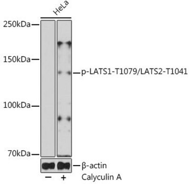 Anti-phospho-LATS1-T1079/LATS2-T1041 antibody produced in rabbit