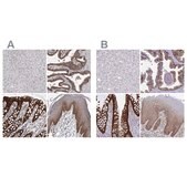 Anti-LIMA1 antibody produced in rabbit Prestige Antibodies&#174; Powered by Atlas Antibodies, affinity isolated antibody, buffered aqueous glycerol solution