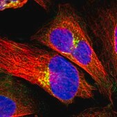 Anti-PDE8A antibody produced in rabbit Prestige Antibodies&#174; Powered by Atlas Antibodies, affinity isolated antibody, buffered aqueous glycerol solution