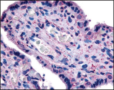 Anti-SLC7A5 (AB2) antibody produced in rabbit affinity isolated antibody, buffered aqueous solution