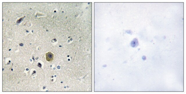 Anti-MEK1 antibody produced in rabbit affinity isolated antibody