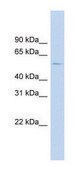 Anti-HTR2B (N-terminal) antibody produced in rabbit affinity isolated antibody
