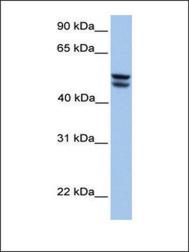Anti-OXCT1 (AB2) antibody produced in rabbit affinity isolated antibody