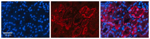 Anti-AQP2 antibody produced in rabbit affinity isolated antibody