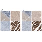 Anti-CACNA2D1 antibody produced in rabbit affinity isolated antibody, buffered aqueous glycerol solution