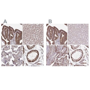 Anti-FMR1 antibody produced in rabbit Prestige Antibodies&#174; Powered by Atlas Antibodies, affinity isolated antibody, buffered aqueous glycerol solution