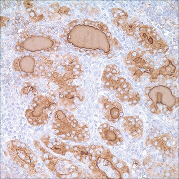 Thyroglobulin (2H11+6E1) Mouse Monoclonal Antibody