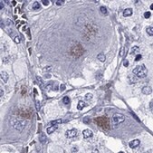 Anti-SLC6A2 Prestige Antibodies&#174; Powered by Atlas Antibodies, affinity isolated antibody