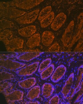 Anti-CEACAM6 Antibody, clone 4Z3V7, Rabbit Monoclonal