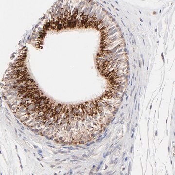 Anti-PDE4B antibody produced in rabbit Prestige Antibodies&#174; Powered by Atlas Antibodies, affinity isolated antibody, buffered aqueous glycerol solution