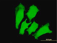 Monoclonal Anti-TNNI3 antibody produced in mouse clone 1E7, purified immunoglobulin, buffered aqueous solution