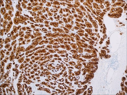 PSMA (EP192) Rabbit Monoclonal Primary Antibody