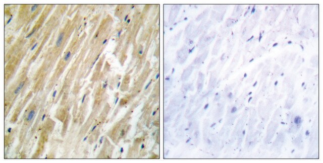 Anti-CALR antibody produced in rabbit affinity isolated antibody
