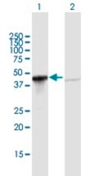 Anti-GIPC1 antibody produced in mouse purified immunoglobulin, buffered aqueous solution