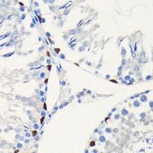 Anti-SOX9 antibody produced in rabbit