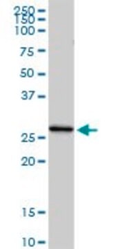 Anti-C1QC antibody produced in rabbit purified immunoglobulin, buffered aqueous solution