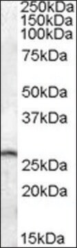 Anti-PSPH (C-terminal) antibody produced in goat affinity isolated antibody, buffered aqueous solution