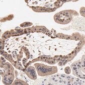 Anti-BIRC5 antibody produced in rabbit Prestige Antibodies&#174; Powered by Atlas Antibodies, affinity isolated antibody, buffered aqueous glycerol solution