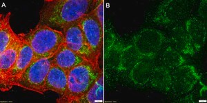Anti-pan-Amylase Antibody, clone 3K13 ZooMAb&#174; Rabbit Monoclonal recombinant, expressed in HEK 293 cells