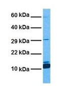 Anti-FABP4 antibody produced in rabbit affinity isolated antibody