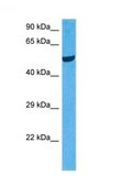 Anti-CALCRL antibody produced in rabbit affinity isolated antibody