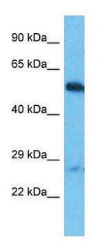 Anti-OTUD1 (C-terminal) antibody produced in rabbit affinity isolated antibody