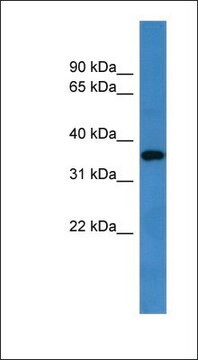 Anti-GPR88 antibody produced in rabbit affinity isolated antibody