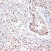 Anti-Phospho-Jak2-Y1007/1008 antibody produced in rabbit
