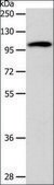 Anti-ADCY1 antibody produced in rabbit affinity isolated antibody