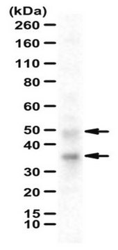 Anti-FcRn/FCGRT Antibody from rabbit, purified by affinity chromatography